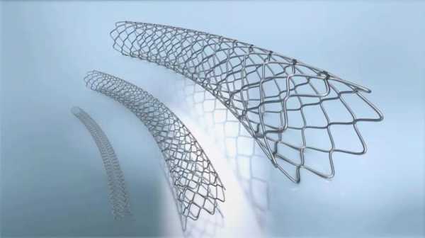 科技重塑心脏健康，揭秘心脏支架最新价格与生活质量提升关联，2023年最新资讯