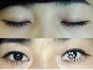 六点定位双眼皮价格,六点定位双眼皮价格，全面解析双眼皮手术费用